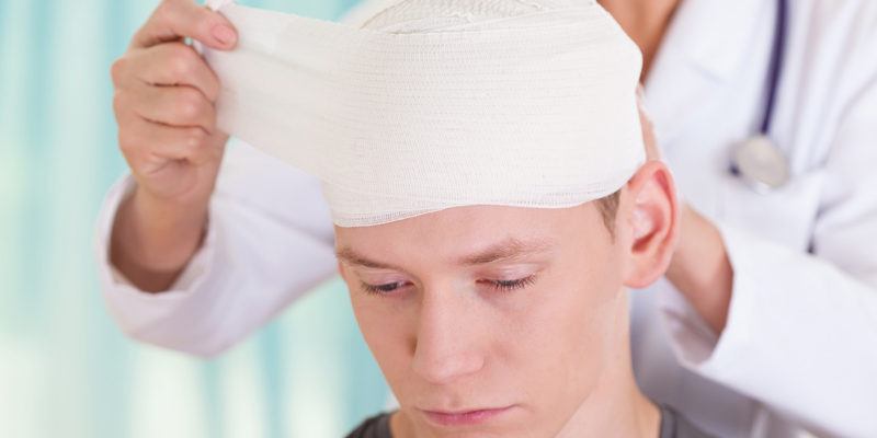 Head Injury